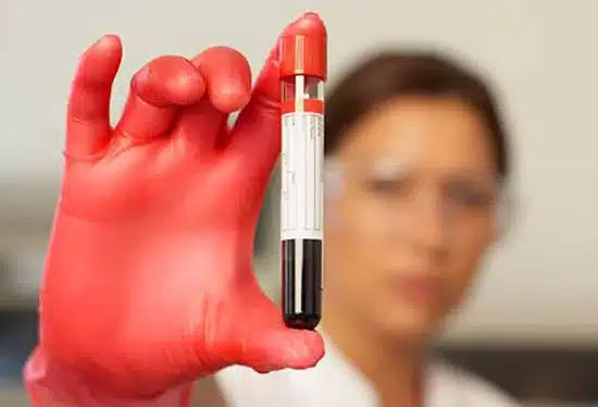 blood testing dui